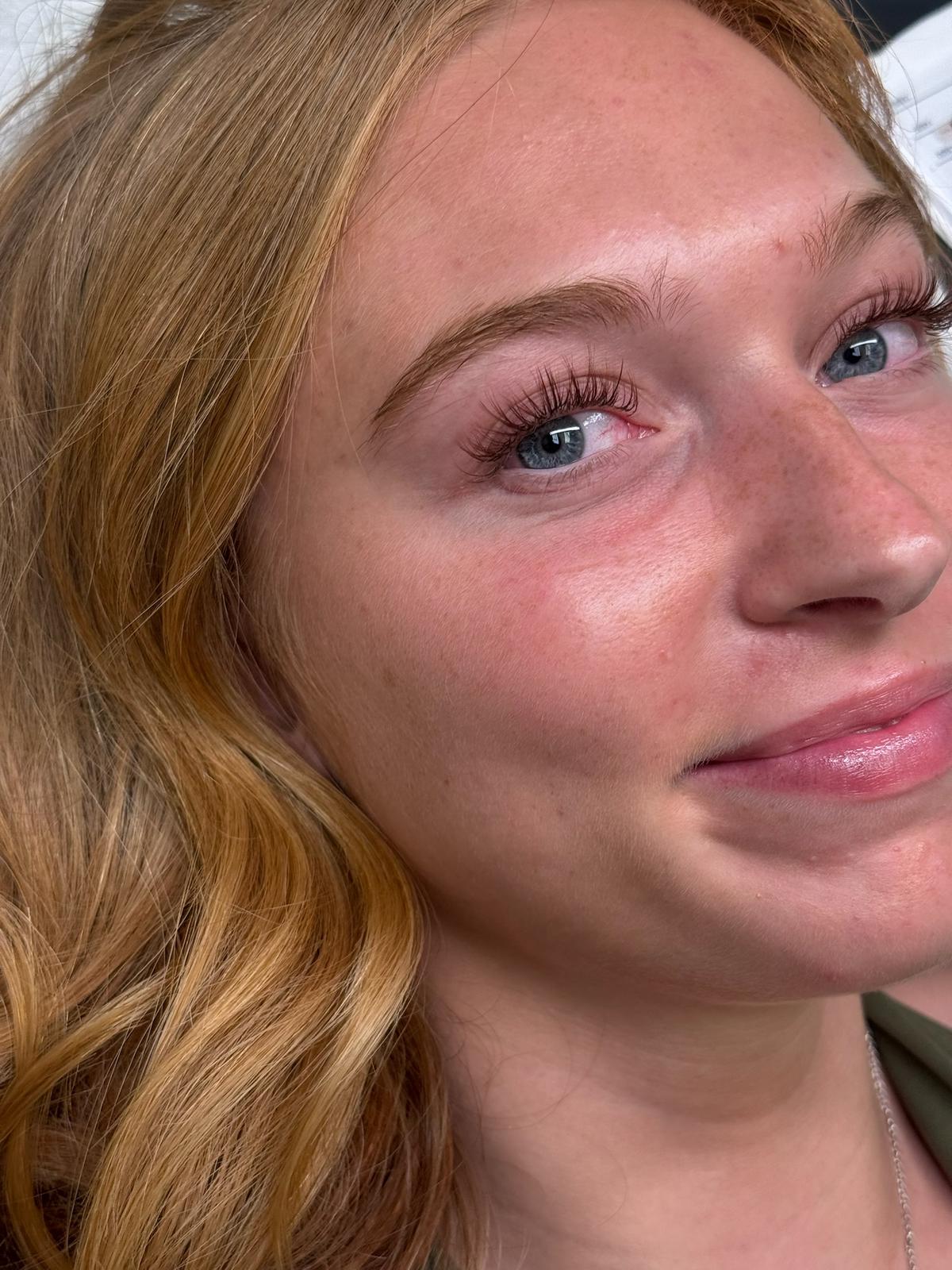 Dermaplane at Ashley York Aesthetics, Peoria AZ